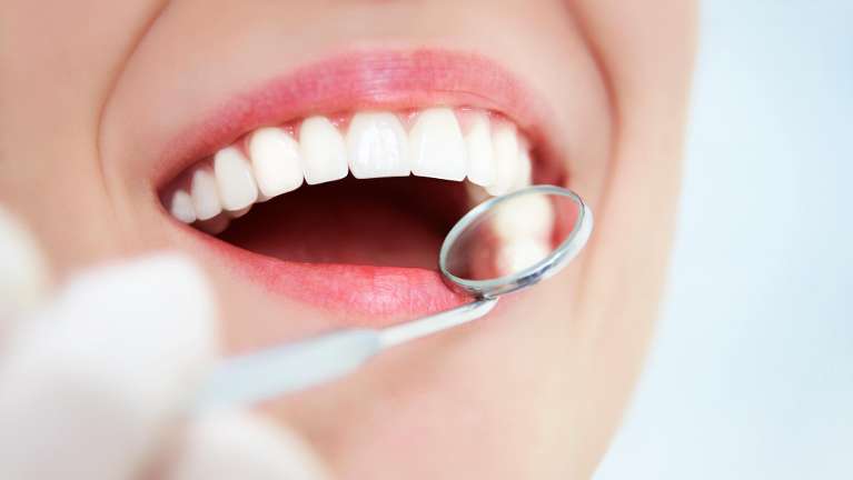 Small dental mirror tool next to an open mouth, glendale ca
