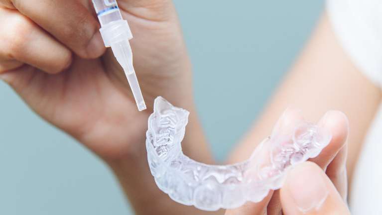 Teeth Whitening
